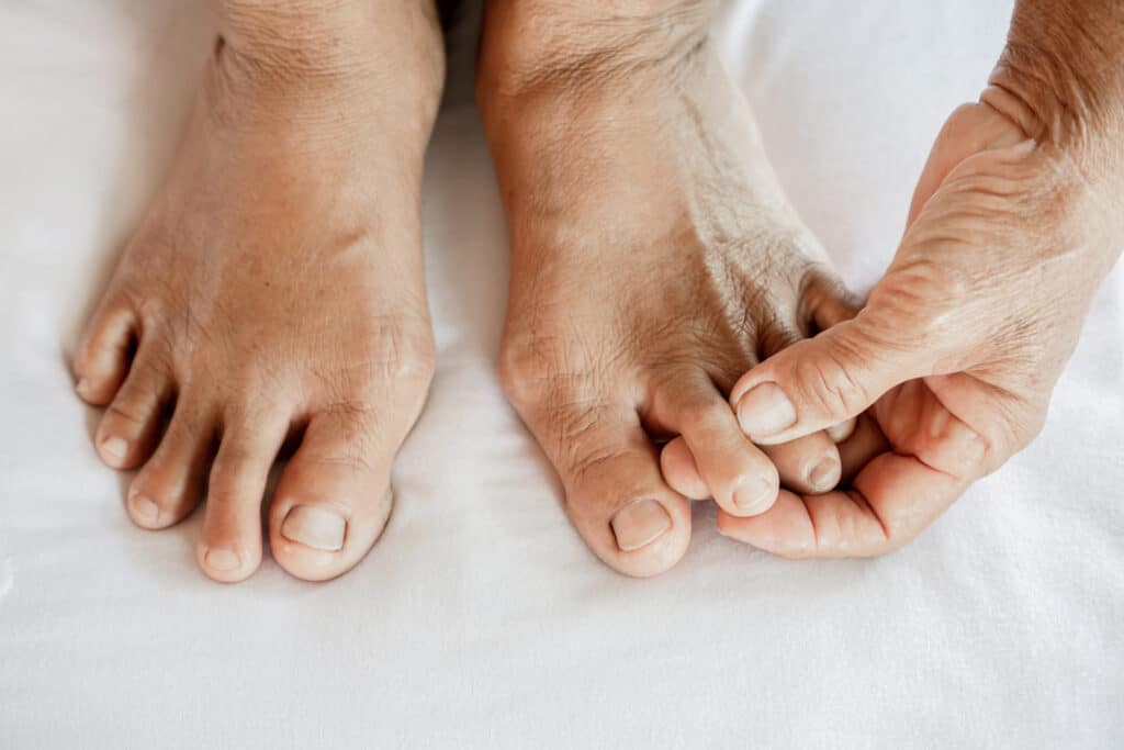 close up of feet suffering from joint pain